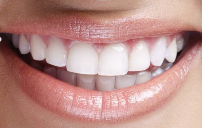 sorriso-lente-web